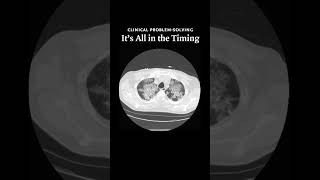 It’s All in the Timing Video 2  NEJM [upl. by Durrell741]