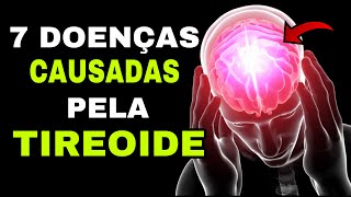 7 DOENÇAS CAUSADAS PELA TIREOIDE Hipotireoidismo e Hipertireoidismo [upl. by Amund304]