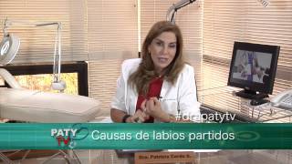 Labios partidos  Dra Paty Tv [upl. by Tobin]