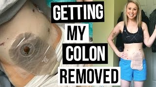 Living with an Ostomy  My Surgery Story  Back to Filming [upl. by Malvin861]