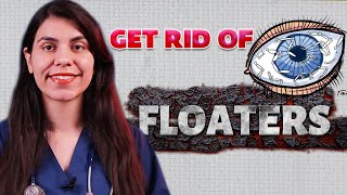 How to Get Rid of Eye Floaters  Eye Floaters Treatment Explained [upl. by Lally758]