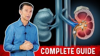 Kidney Stones 101 Causes Symptoms amp Remedies – DrBerg [upl. by Rema366]