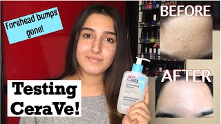 Testing CeraVe SA Smoothing Cleanser And Cream  Cure Forehead Bumps And Keratosis Pilaris [upl. by Nairbal]