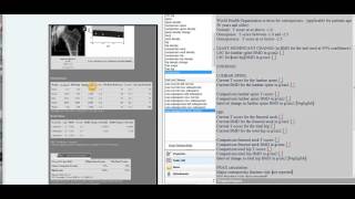 DXA DEXA scan comparing to prior scans and determining significance of BMD change versus LSC [upl. by Letizia]