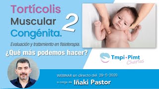 Webinar Torticolis Muscular Congénita  2° Parte  Iñaki Pastor [upl. by Okoyk23]