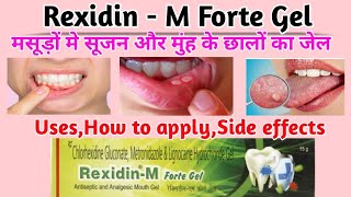 Rexidin m forte gel। मुंह के छालों का जेल। rexidin m forte gel how to use। mouth ulcer gel। [upl. by Ailev531]