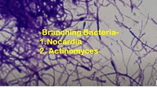 Branching bacteria under the Microscope [upl. by Namus]