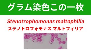 今日のグラム染色この一枚 Stenotrophomonas maltophiliaによる菌血症 [upl. by Luap]