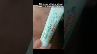 Aziderm 10 cream review how to use azelaic acids cream 10 ww shorts youtubeshorts [upl. by Miche120]