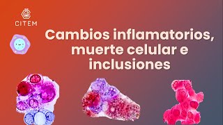 CÉLULAS DEL SEDIMENTO URINARIO  Cambios inflamatorios muerte celular e inclusiones [upl. by Putscher855]