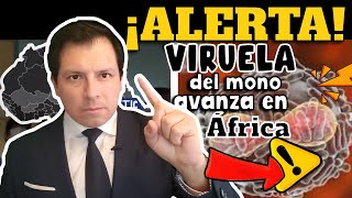 ALERTA⚠️ VIRUELA DEL MONO AVANZA EN ÁFRICA [upl. by Ahsela4]