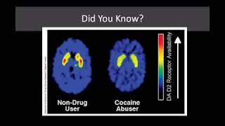 Lecture 12 The Neurobiology of Addiction From Use to Addiction [upl. by Hege]