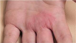 Dermatology Treatments  How to Diagnose Skin Rashes [upl. by Quintina306]