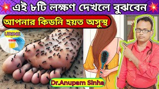 💥এই ৮টি লক্ষণ দেখলেই বুঝবেন আপনার কিডনি খারাপ হতে শুরু হয়েছে। Early Signs Of Kidney Disease [upl. by Reames484]