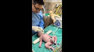 Saving a Life Live Neonatal Resuscitation in labour room using a TPiece Resuscitator [upl. by Meehsar296]