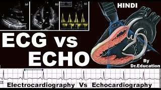 Rx Heart epi 16 h  ECG vs ECHO HINDI Electrocardiography vs Echocardiography DrEducation [upl. by Grof]