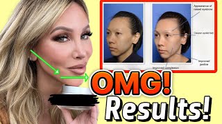 Get a TIGHTER JAWLINE FIRM UP SAGGING SKIN with THIS 100 Results 😱 [upl. by Llain642]