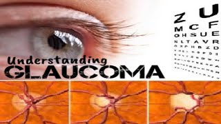 Understanding Glaucoma  Signs Symptoms Diagnosis amp Treatment [upl. by Eerazed]