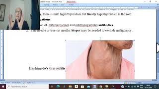 Thyroid disorders in Arabic 24  Inflammatory Goiter   by Dr Wahdan [upl. by Ubald]