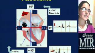 Cómo interpretar un ECG repaso [upl. by Free]