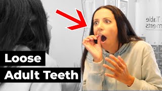 why your teeth feel LOOSE amp what to DO about it [upl. by Aramoj72]