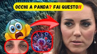 SCOPRI come ELIMINARE gli OCCHI a PANDA 🐼🥰 benessere rimedinaturali [upl. by Wolcott]