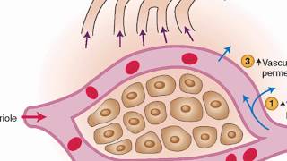 Mechanisms of edema development [upl. by Aicena751]