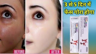 यह क्रीम से। 2 दिन में काले चेहरा गोरा हो जाएगा  Medisalic Cream Honest Review [upl. by Irollam512]