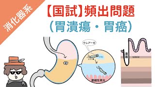 【国試対策】胃の疾患（胃潰瘍・胃がん・ダンピング症候群） [upl. by Nert]