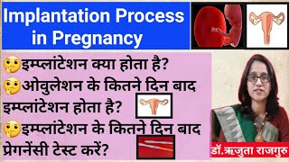 Implantation bleeding vs periods।।इम्प्लांटेशन ब्लीडिंग क्या है कब होती है कितने दिन तक होती है। [upl. by Llireva446]