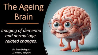 Imaging of dementia and brain ageing [upl. by Elita782]