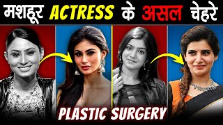 Famous ACTRESSES के असली चेहरे जो 99 लोग नहीं जानते  SHOCKING Plastic Surgery Of Famous Actresses [upl. by Rosco]