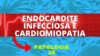 ENDOCARDITE INFECCIOSA E CARDIOMIOPATIA  PATOLOGIA 24 [upl. by Wain608]