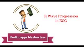 R Wave Progression on ECG [upl. by Seabury]