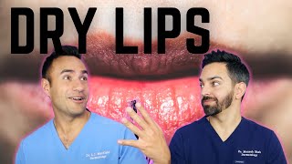 DRY CHAPPED LIPS DERMATOLOGY TIPS [upl. by Ennoval]