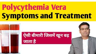 Polycythemia Vera Symptoms and Treatment in Hindi  Blood Cancer Causing High HB [upl. by Enelec332]