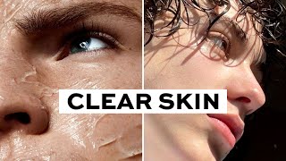 How To Get Clear Skin only 3 steps [upl. by Blackman588]