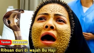 Jakarta HuruHara 7 Kali Haji Malah Tumbuh Duri Neraka di Wajah Wanita ini  Khan Voice [upl. by Tutankhamen]