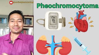 Pheochromocytoma  Cause Symptoms And Treatment  medicalpharmacology mbbs [upl. by Jorin]