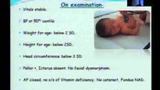 Case presentation on a child with Tyrosinemia [upl. by Llerdnek]