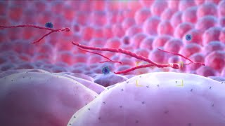 Ebola Virus  Mechanism of Action  3D Medical Animation [upl. by Cnahc]