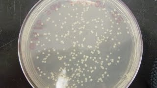 CFU Colony Forming Unit amp cfuml calculation [upl. by Isolda817]