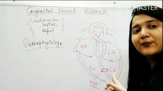 Ventricular septal defect congenital heart diseaseeasy explanation in hindi [upl. by Mayyahk]