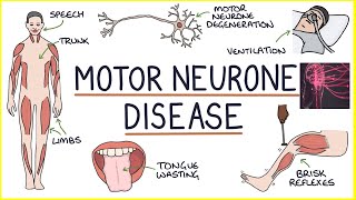 🩺What are Motor Neuron Diseases❓ They are a type of nerve cell 🔴You have two main types🔴 [upl. by Annodas]