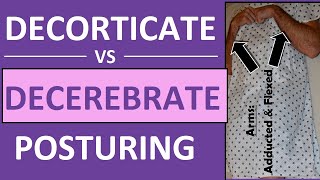 Decerebrate vs Decorticate Posturing Rigidity Mnemonic amp Pictures Nursing NCLEX [upl. by Ennaid712]