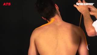 Taping Elastico®  Applicazione Cervicale [upl. by Sokram]