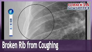 Patient with persistent cough breaks rib in a violent coughing fit｜Taiwan News [upl. by Essilec]