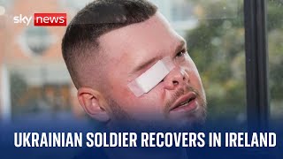 Ukraine War Ukrainian soldier recovers in Ireland after losing eye [upl. by Ietta]