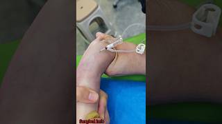 How to insert iv cannula in children song trending shorts [upl. by Esmeralda]