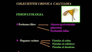 COLECISTITIS CRONICA Y AGUDA [upl. by Anwahsak631]